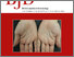 [thumbnail of British_journal_of_dermatology_2017_2_cover.jpg]